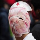 Pasarte el día cual cíclope no debe ser nada agradable. Valoramos la incomodidad.