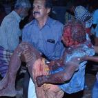 5c8aa78d230000dd04237096