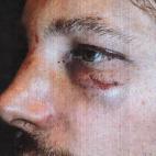 5c8b56c22400004205a477c1