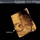 5c8acad82500001304c9a837