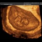 5c8acad82300005300e72e83