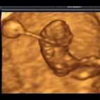 5c8acad82500000a0681c1d4