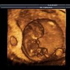 5c8acad92000009e046fc1e5