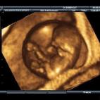 5c8acad9240000f404a3b241