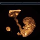 5c8acad92400006d054c7740