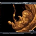 5c8acad93b000002076c9565