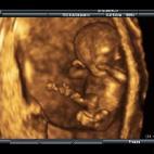 5c8acada230000d50423b7b2