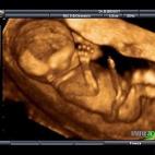 5c8acada2400006b054c7742