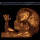 5c8acada2400006b054c7744