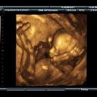 5c8acada360000c81a6c148e