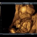 5c8acadb2400006b054c7746