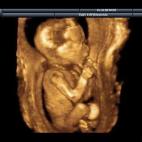 5c8acadb360000e01c6c1492