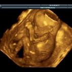 5c8acadc3b000002076c956b