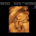 5c8acadc2400006c05a3b245