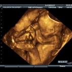 5c8acadc2300005300e72e8f