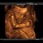 5c8acadc3b000002076c956d