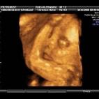 5c8acadd3b000054066c956f