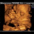 5c8acadd3b000002076c9571