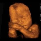 5c8acadd2500000704c9a841