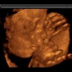 5c8acade2500001304c9a843