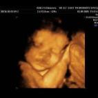 5c8acade2000009e046fc1f3