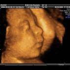 5c8acade2300005300e72e95