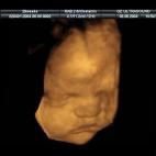 5c8acade240000f7054c7750