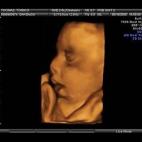 5c8acadf2000009d036fc1f6