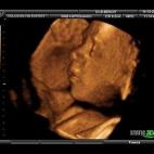 5c8acadf2000009d036fc1f9