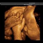 5c8acadf250000520681c1e2