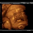 5c8acadf2400000a05a3b249