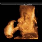 5c8acae02400000a05a3b24b