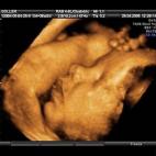 5c8acae02300007f0123b7c3