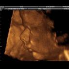 5c8acae124000093024c7754