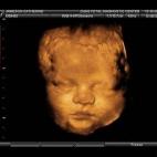 5c8acae12400006d054c7756