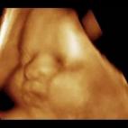 5c8acae23b000054066c957d