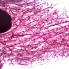 Isabel Hernández, Autumn tree (Árbol de otoño).