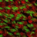 Miguel Foronda, The skin from a hair's breadht distance (La piel vista desde una distancia mínima).