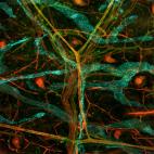 Rodrigo Dieguez, A colored map of the vascular network (Un mapa en color de la red vascular).