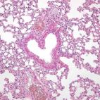 Chiara Ambrosio, Romantic Lung (Pulmón romántico)