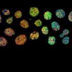 Lucía Morgado, Induced pluripotent kaleidoscope (Caleidoscopio pluripotente inducido).