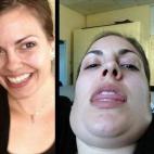 5c8b2aba22000033001a738c