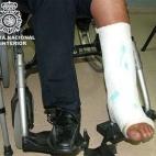 En marzo de 2009, la Policía detuvo a un pasajero en El Prat que portaba casi cinco kilos de cocaína en una escayola