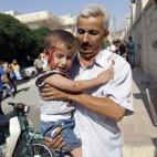 Según datos recogidos por Save The Children en uno de los hospitales que tiene instalados en Siria, el 24% de los pacientes que ingresan son menores de 14 años. La mayoría llega con quemaduras graves, heridas profundas y fracturas abiertas pr...