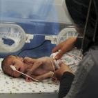 A las dificultades que tienen las mujeres para dar a luz en condiciones saludables, hay que añadir la falta de recursos sanitarios para los bebés. Los cortes de luz durante los meses de invierno y la falta de incubadoras hacen que muchos muer...