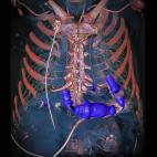 El jurado de los Wellcome Image Awards de este a&ntilde;o, formado por periodistas especializados y cient&iacute;ficos, ha reconocido con el primer premio a esta imagen obtenida mediante tomograf&iacute;a computerizada de energ&iacute;a dual (DE...