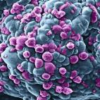 Esta imagen puede parecer no decir nada pero se vuelve sobrecogedora al saber que las lo azul son células cancerosas de un cáncer de pecho. Las de color púrpura son también cancerígenas pero que han sido aniquiladas gracias a una medicina a...