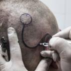 5c8b0b8e230000d50423fc4c