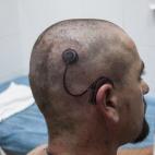 5c8b0b8f2300005300e77407