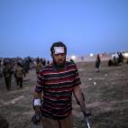 Un supuesto miliciano del EI, herido levemente, tras su salida del &uacute;ltimo basti&oacute;n yihadista.